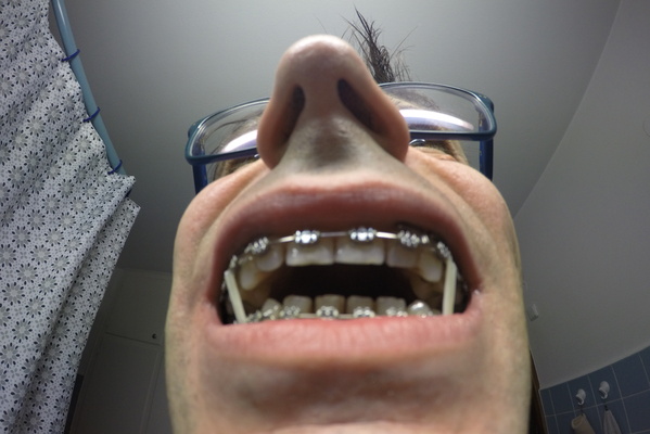 The Grin of the Metal Dragon.