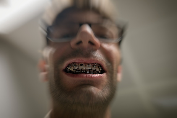 Orthodontic Delight (Said No One Ever)