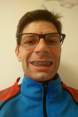Smiling with Metal