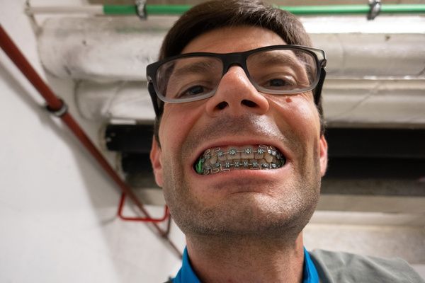 Smile Wide! Sharing My Braces Adventure