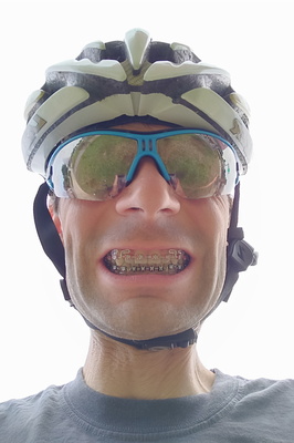 Smiling Through the Ride: Braces and Bike Adventures