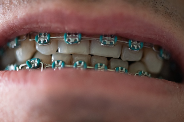 The Secret Language of Smiles