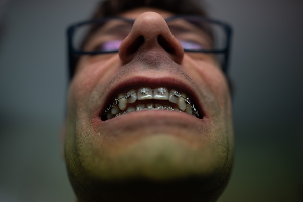 Metal Mouth Musings: A Braced Retrospective