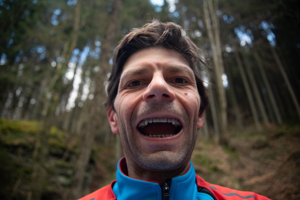 Brace Face: A Grinning Adventure