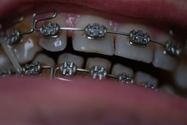 Metal Mouth Adventures