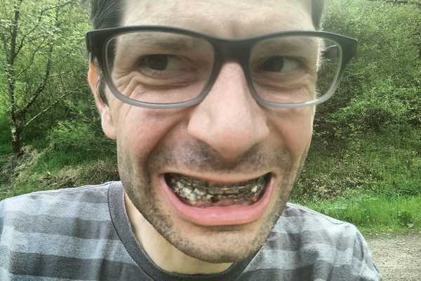 Metal Smile, Extra Food Storage