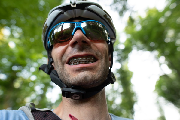 The Braced Warrior: Conquering Trails and Orthodontic Challenges