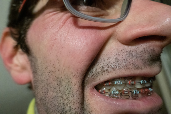 The Metallic Smile of Progress
