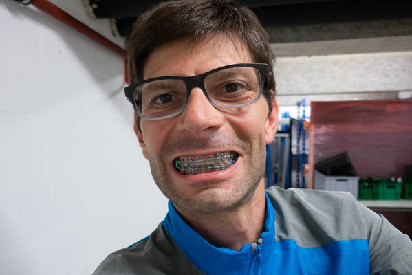 What Colour Next? A Braces Conundrum