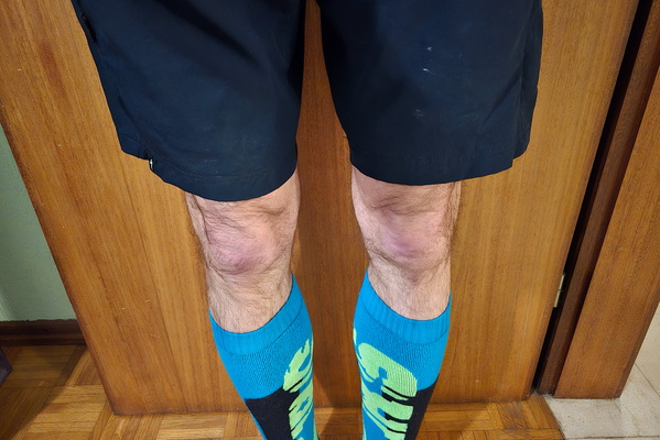 Fashion Disaster or Functional Footwear?